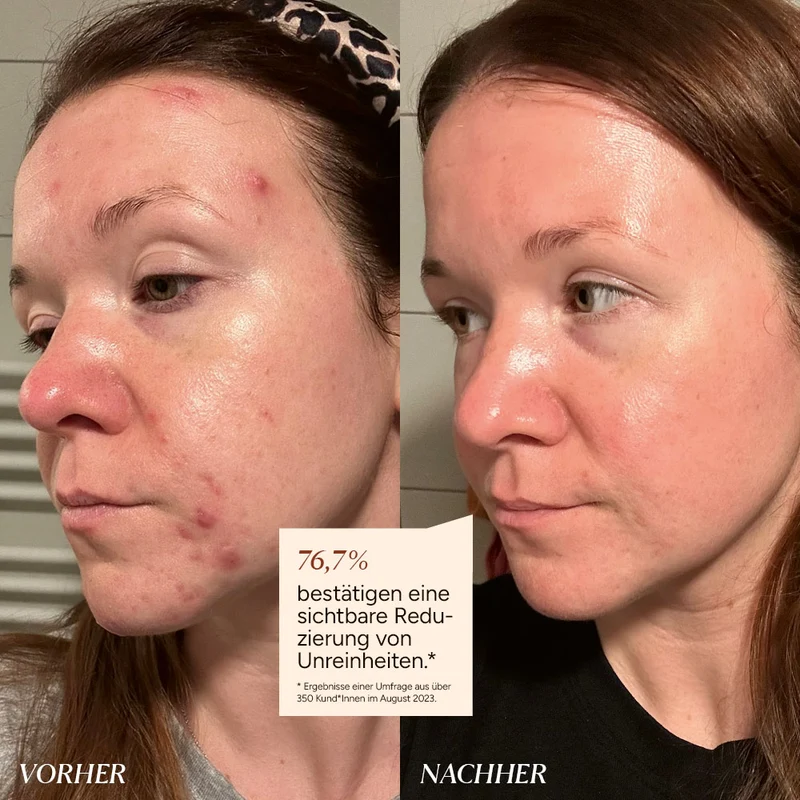 Kennenlern Set Bye Bye Breakouts